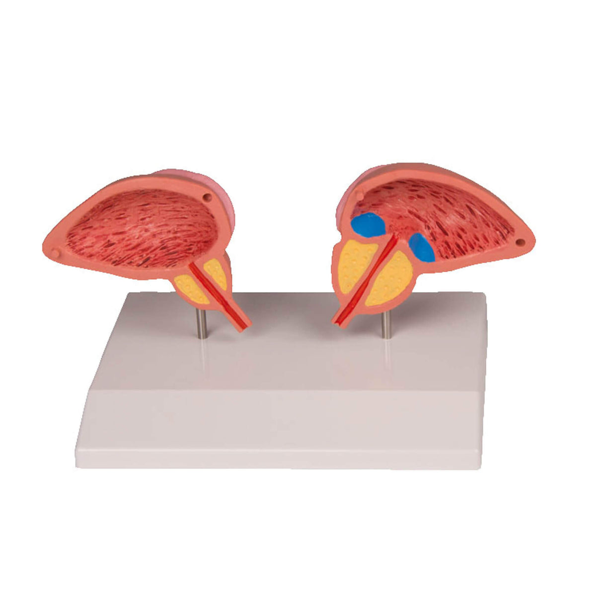 Erler-Zimmer Prostata Modell 2 teilig