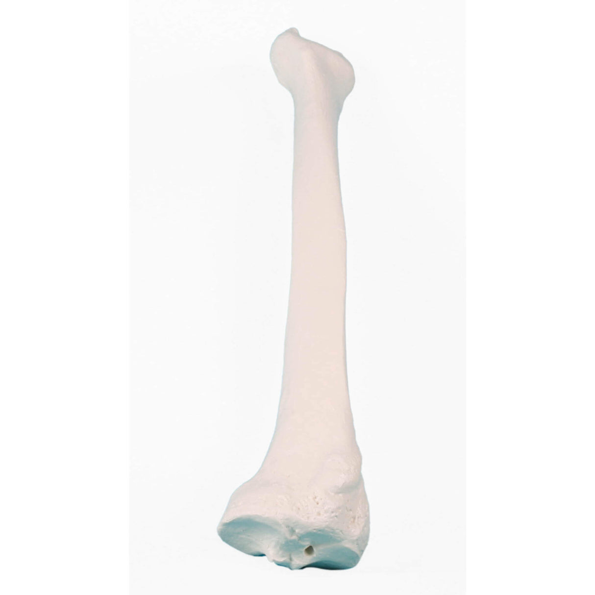 Erler-Zimmer Speiche Modell Radius