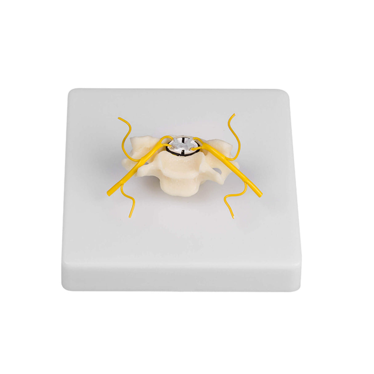 Erler-Zimmer Wirbel Modell mit Rückenmark