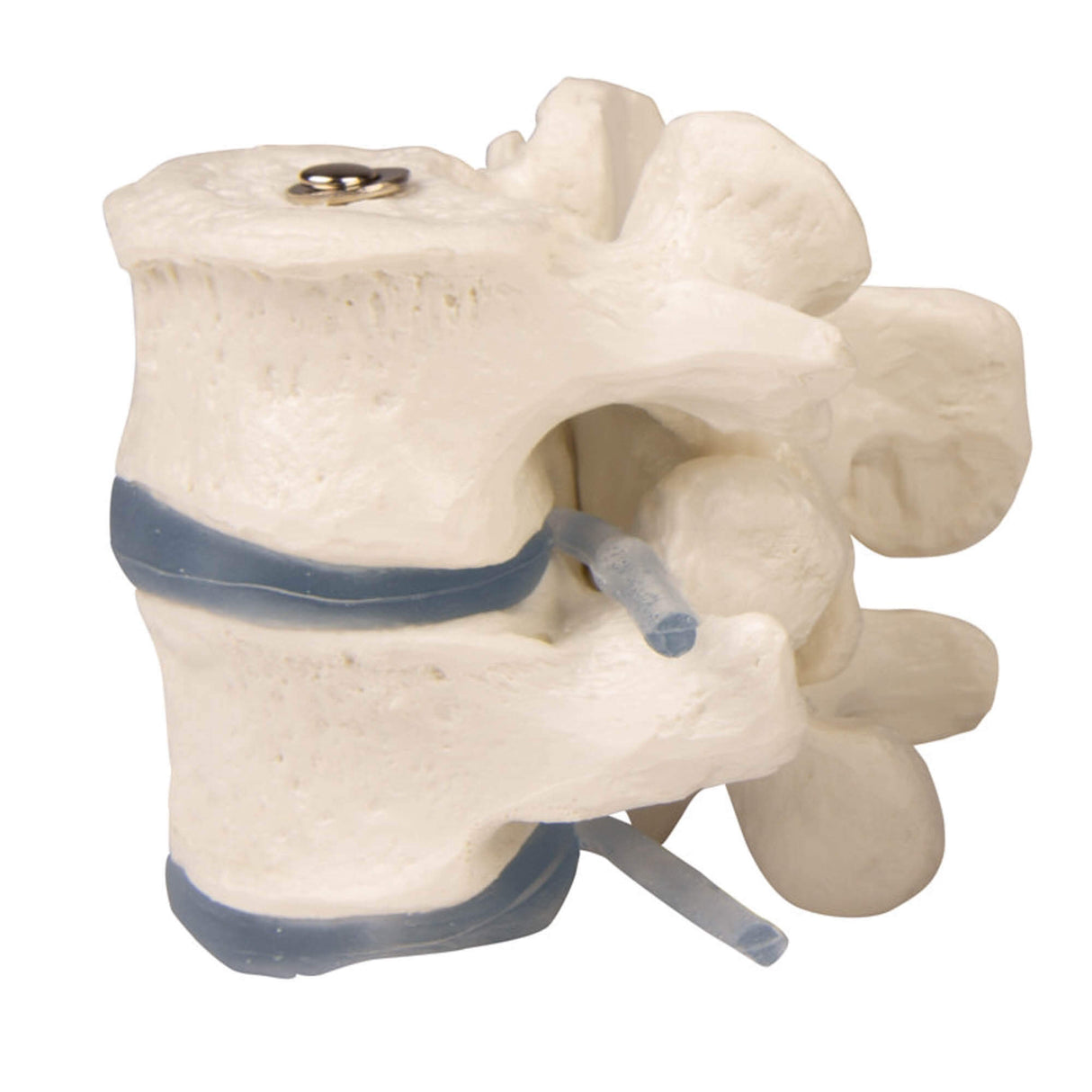 Erler-Zimmer 2 Lendenwirbel Modell