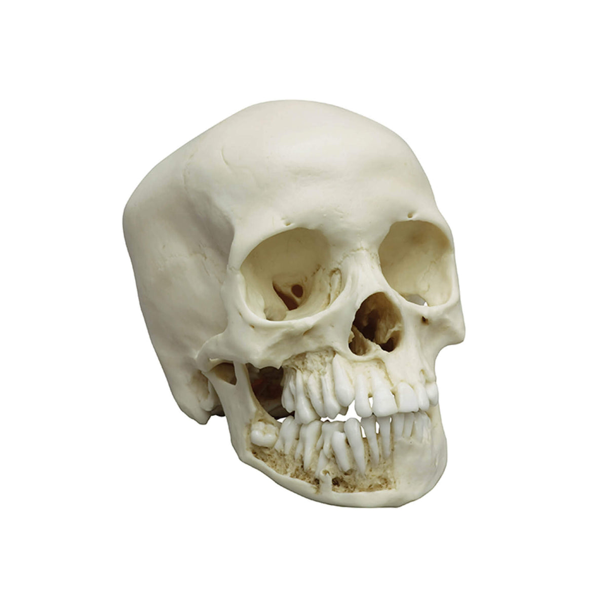 Erler-Zimmer Kinderschädel Modell 12 jährig