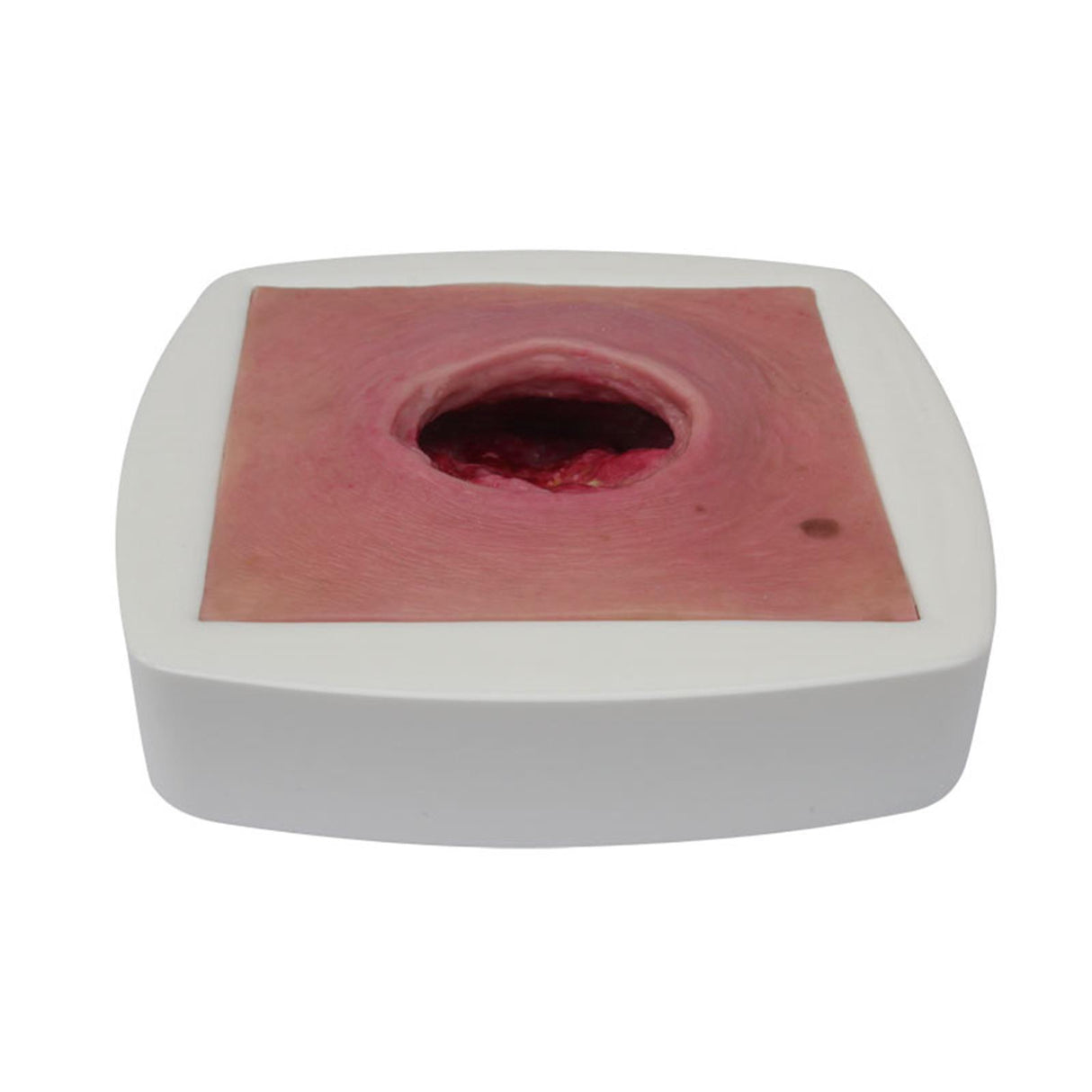 Erler-Zimmer Dekubitus tief Tischmodell im Rahmen