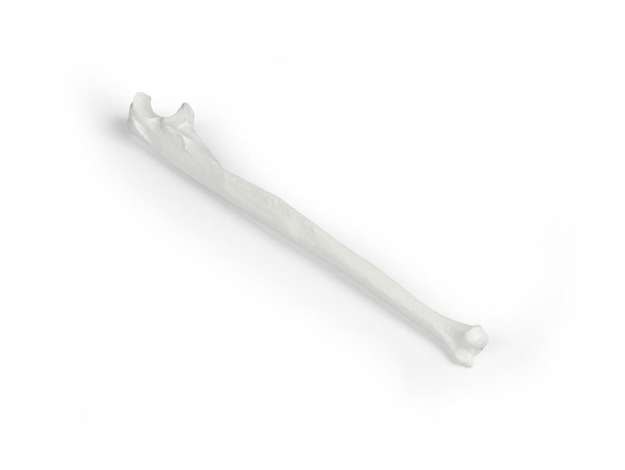 Erler-Zimmer Elle Modell Ulna