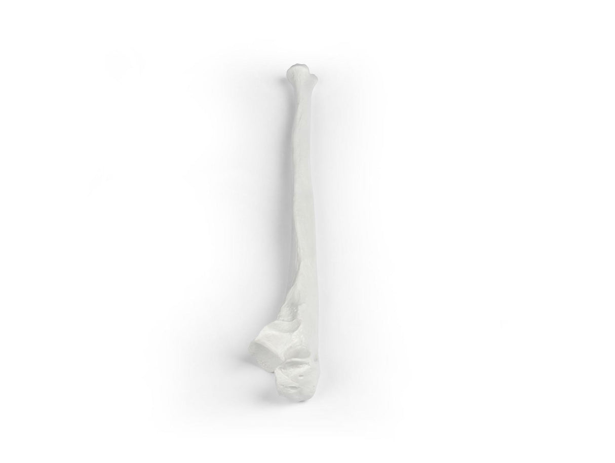 Erler-Zimmer Elle Modell Ulna