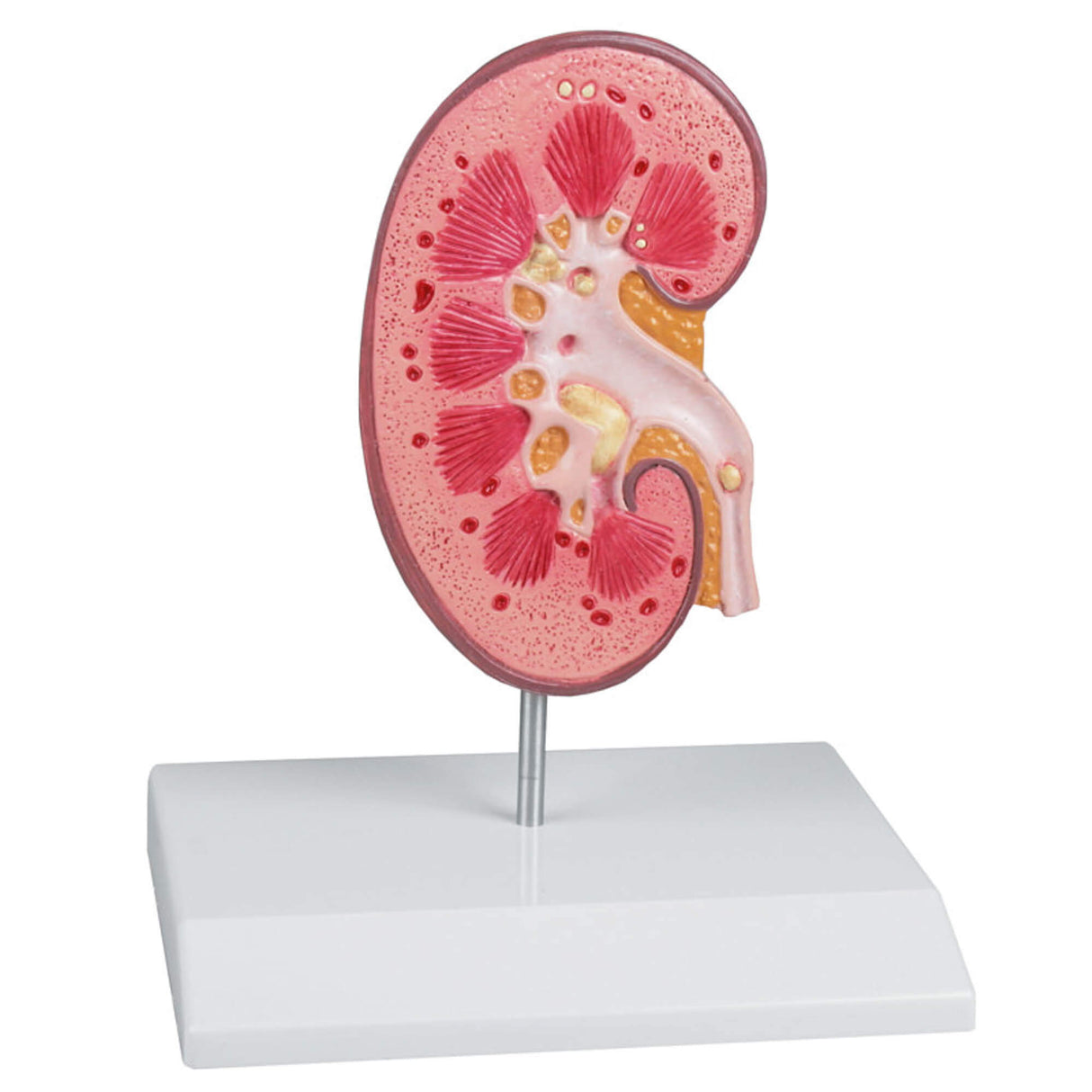 Erler-Zimmer Nierensteinmodell