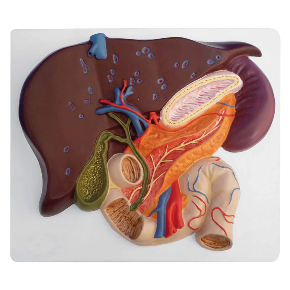 Erler-Zimmer Leber Modell mit Gallenblase Pankreas und Duodenum
