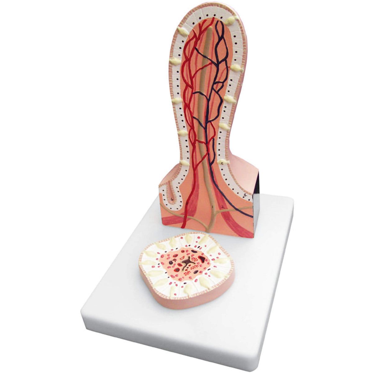 Erler-Zimmer Darmzotte Modell vergrößert 2 teilig