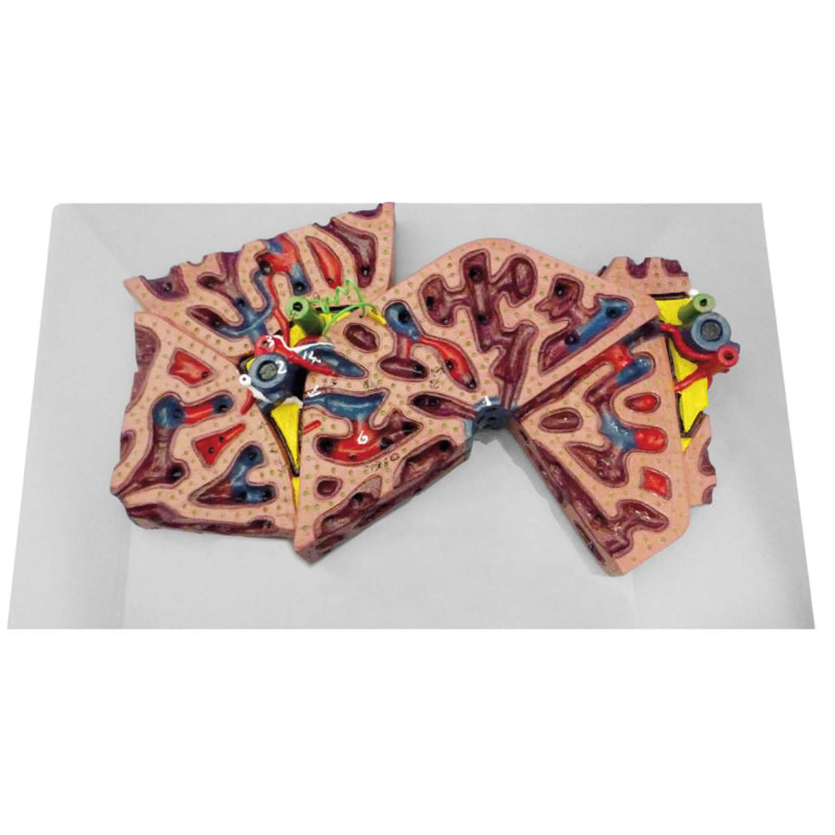 Erler-Zimmer Leberläppchen Modell