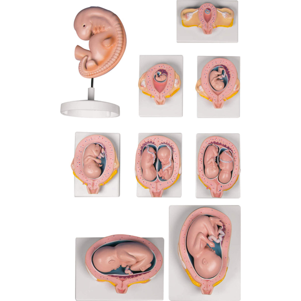 Erler-Zimmer Schwangerschaftsserie 9 Modelle