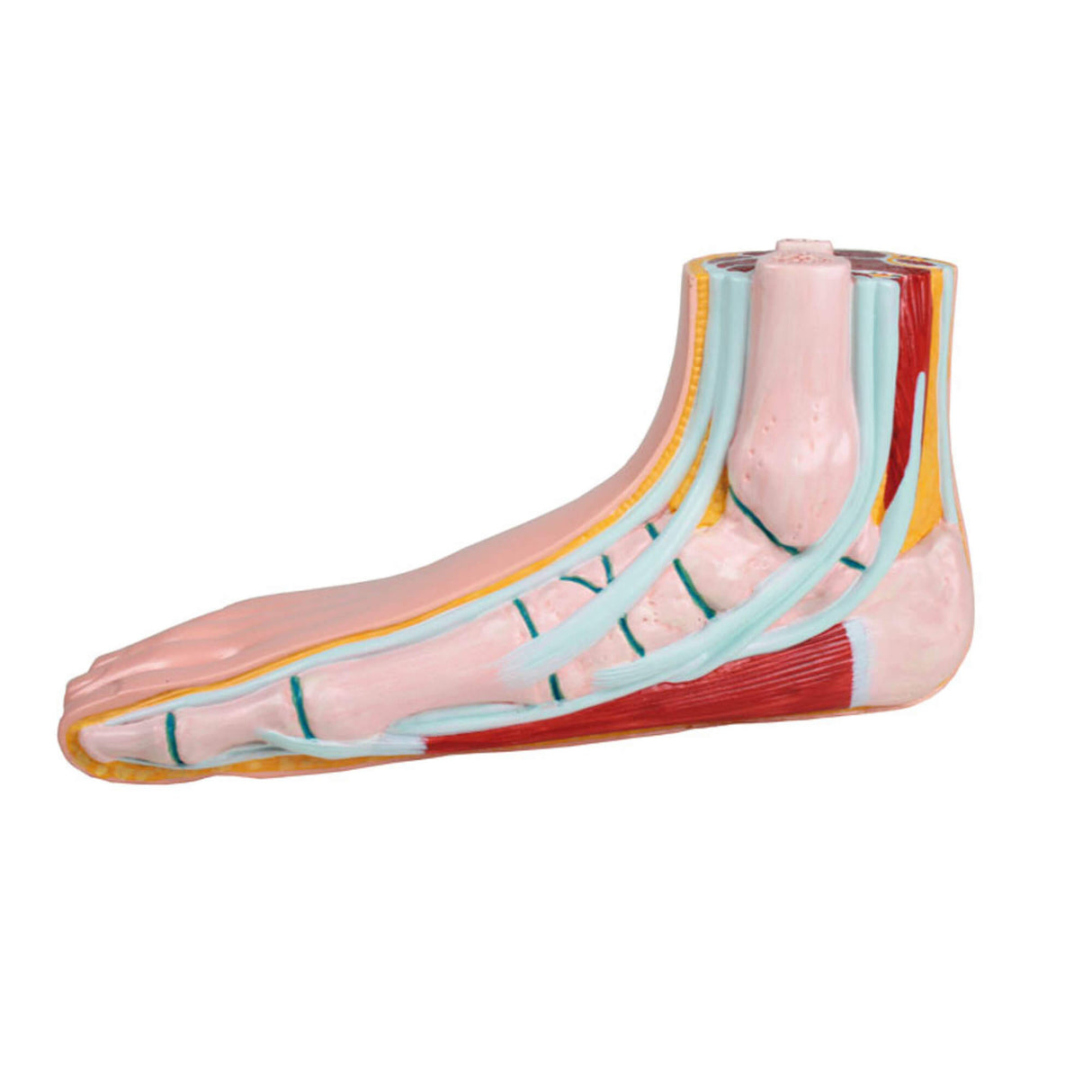 Erler-Zimmer Plattfuß pes planus lebensgroßes Modell