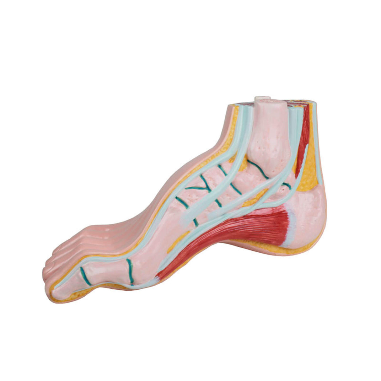 Erler-Zimmer Hohlfuß pes cavus lebensgroßes Modell