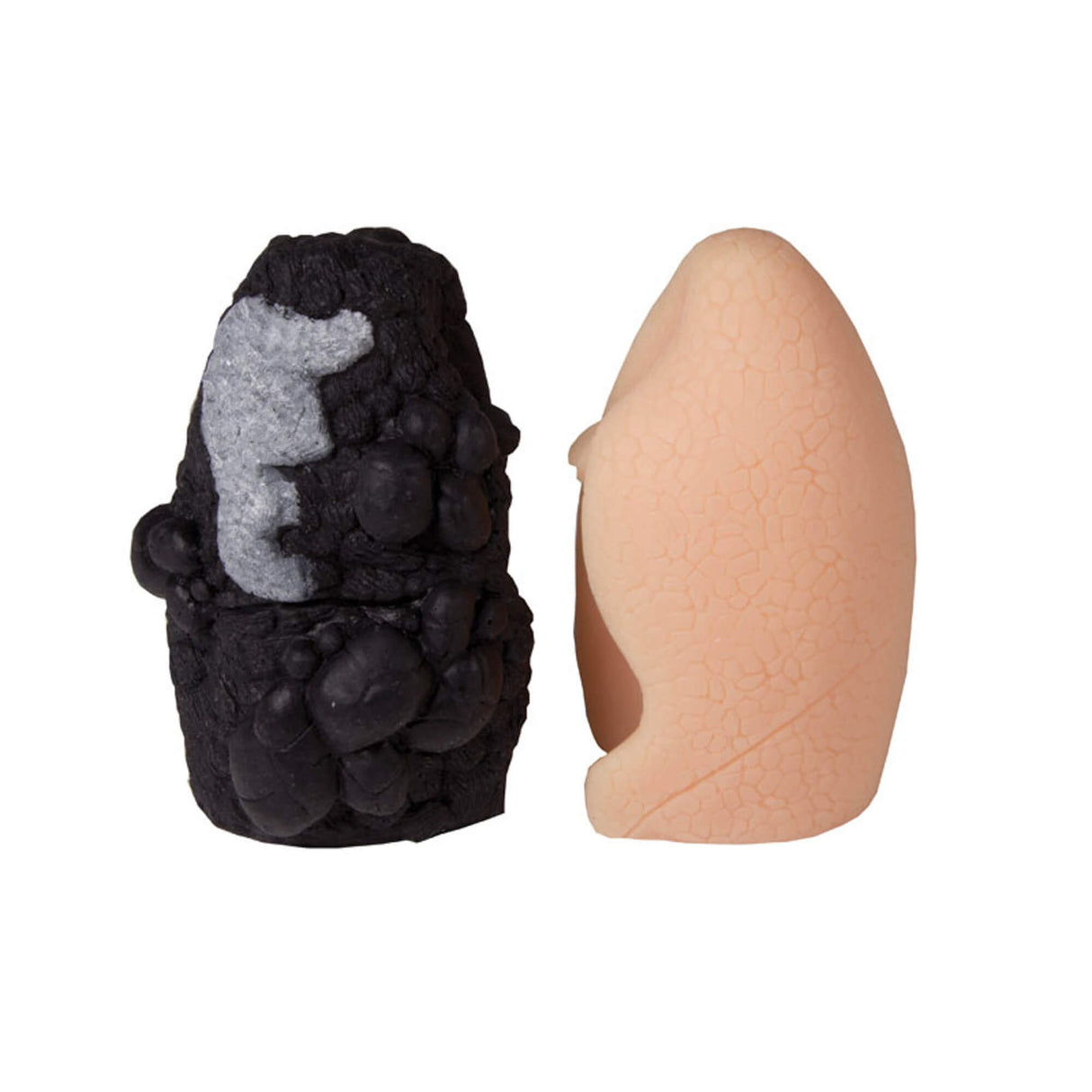 Erler-Zimmer Lungenkrebs Vergleichsmodell