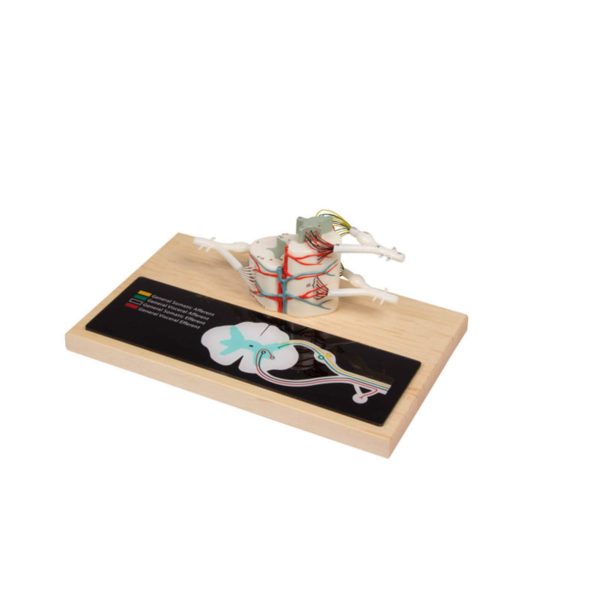 Erler-Zimmer Rückenmarkmodell 6 fache Größe