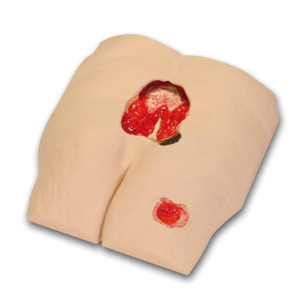 Erler-Zimmer Stan Stufe IV Dekubitus Simulator