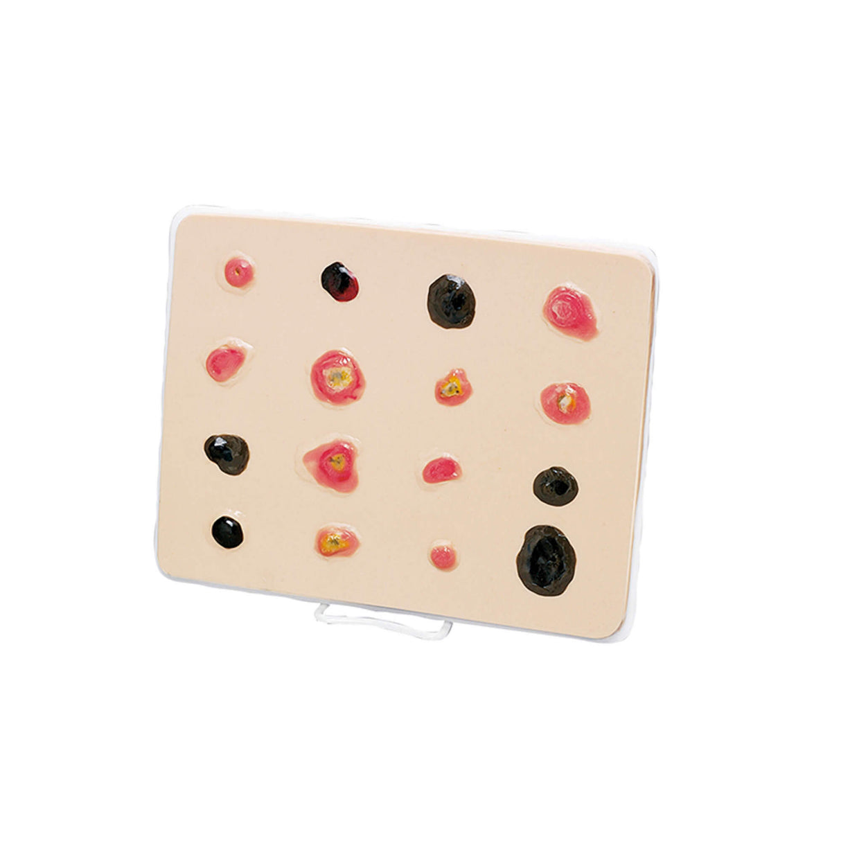 Erler-Zimmer Übungsmodell Weißer Hautkrebs – vergrößert