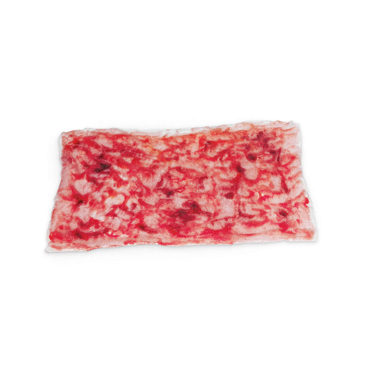 Erler-Zimmer Simulierte Verbrennungen 2. Grades tief