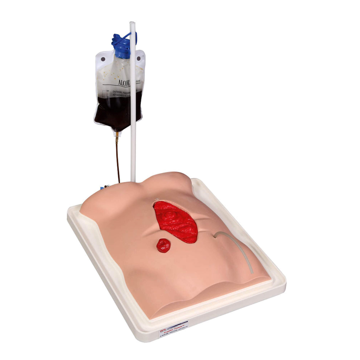 Erler-Zimmer Freddie Fistula Übungsmodell mit Koffer