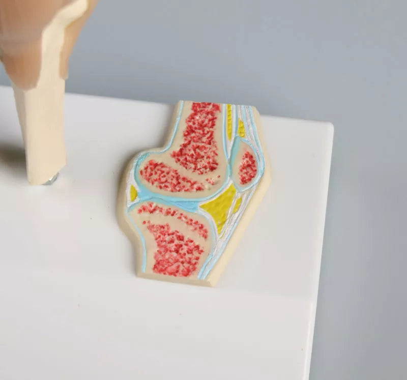 Erler-Zimmer Mini Kniegelenkmodell mit Querschnitt