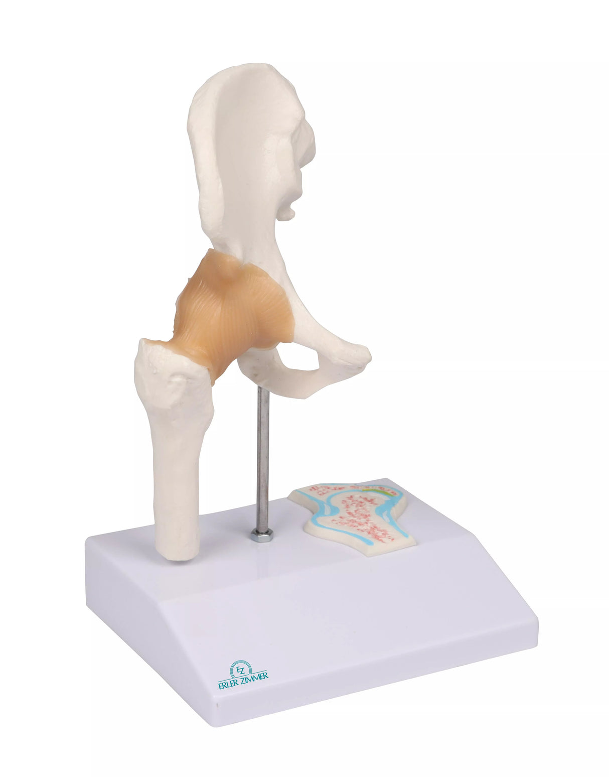Erler-Zimmer Mini Hüftgelenkmodell mit Querschnitt