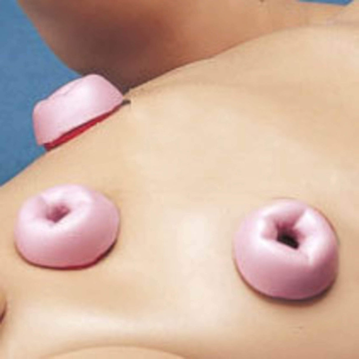 Erler-Zimmer Externe Stomata für R17710