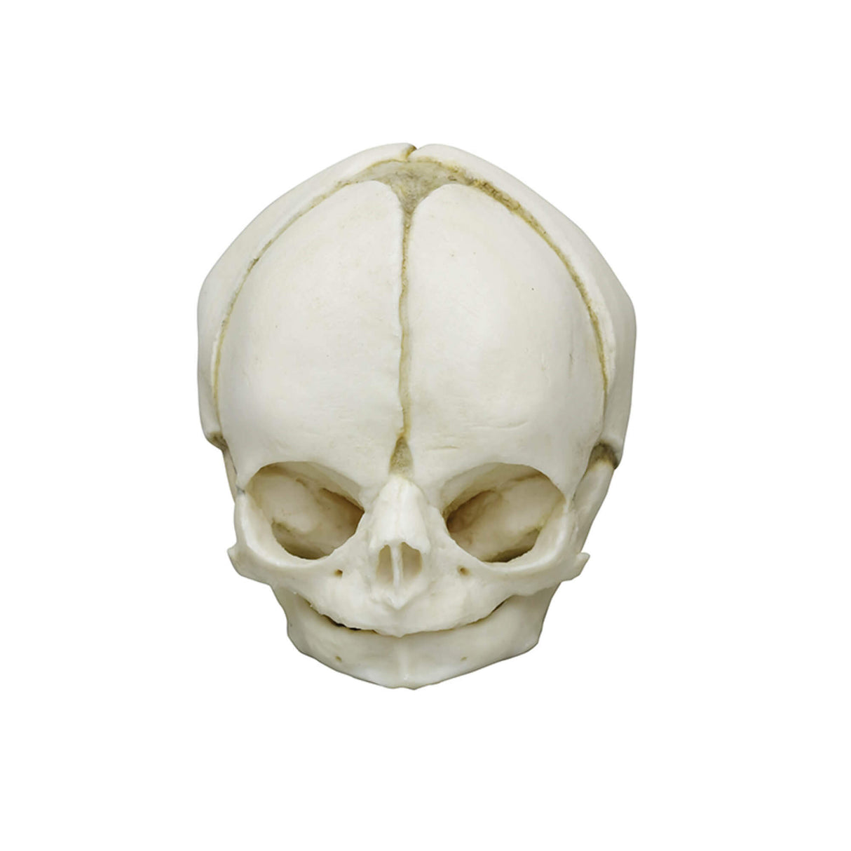 Erler-Zimmer Fetusschädel