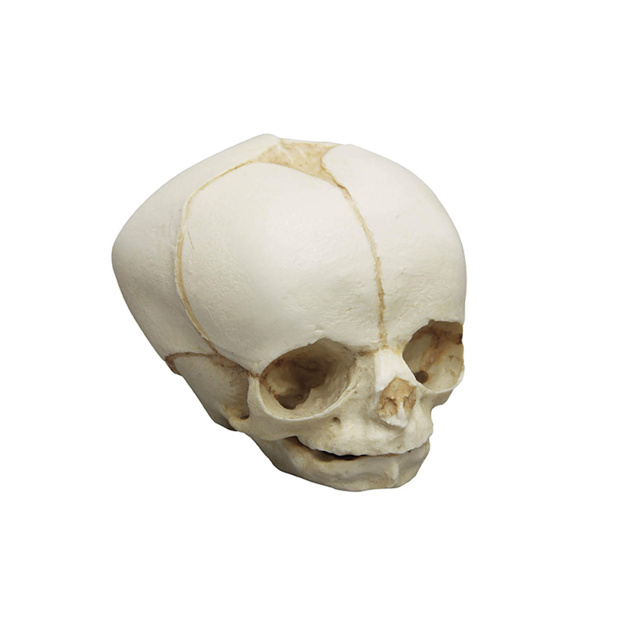 Erler-Zimmer Fetusschädel