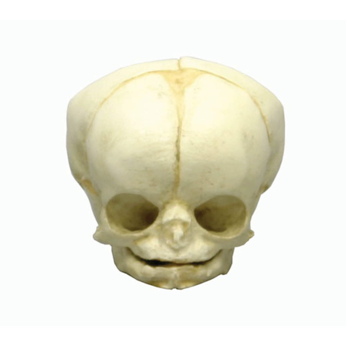 Erler-Zimmer Fetusschädel