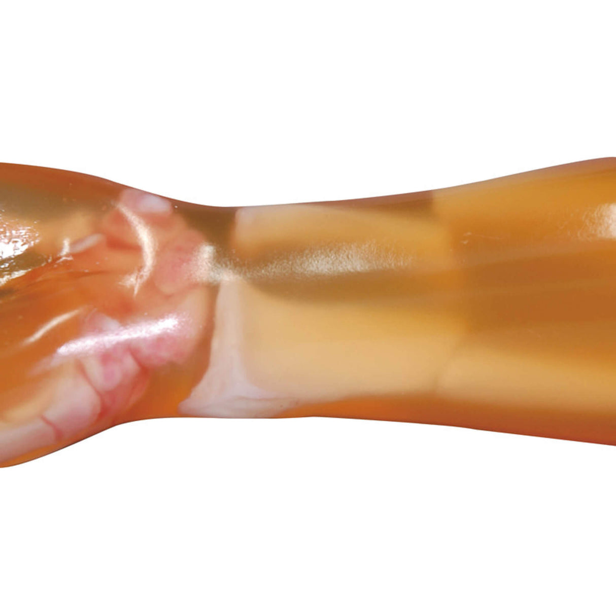 Erler-Zimmer Frakturenhand mit Unterarm für R16900