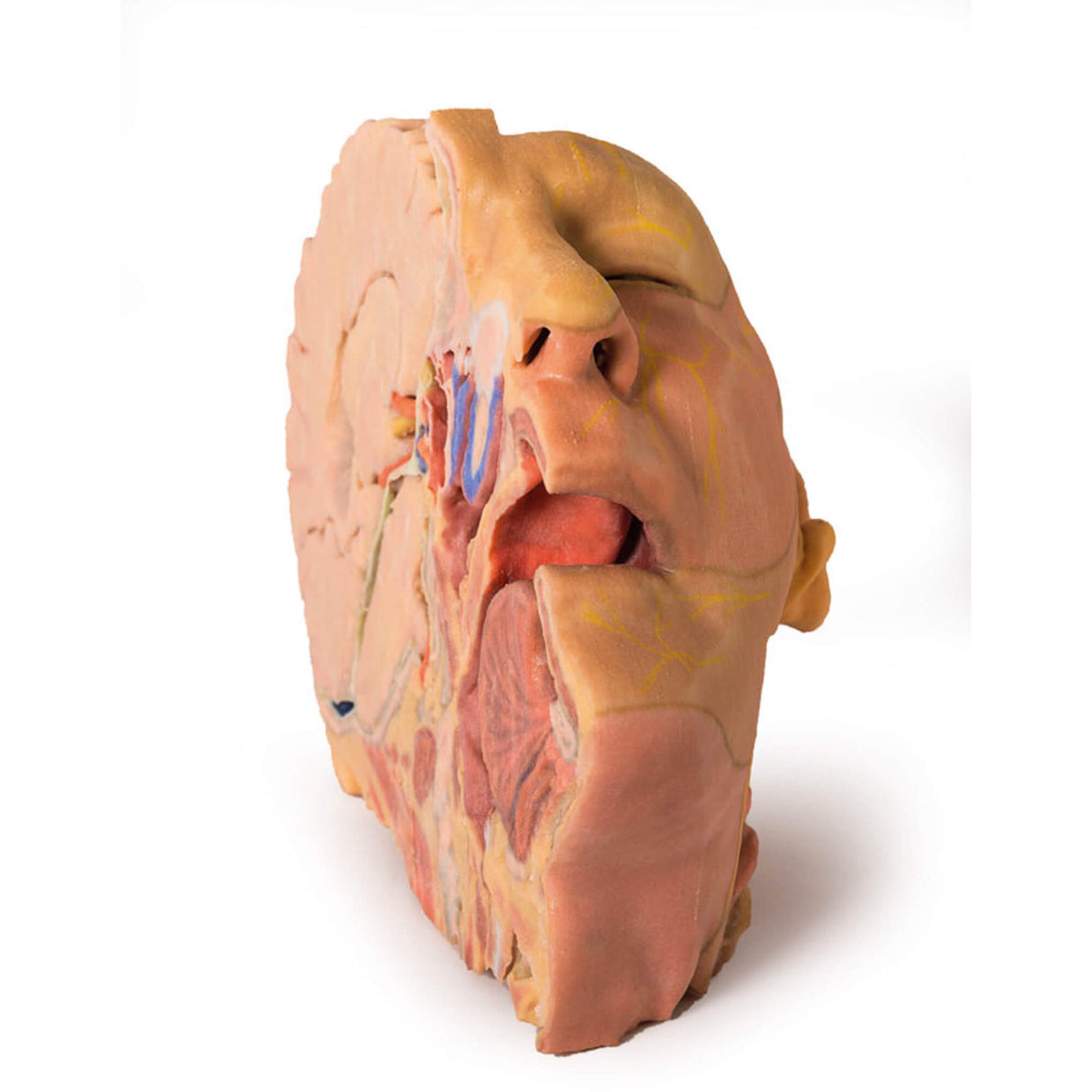 Erler-Zimmer Kopf und Hals