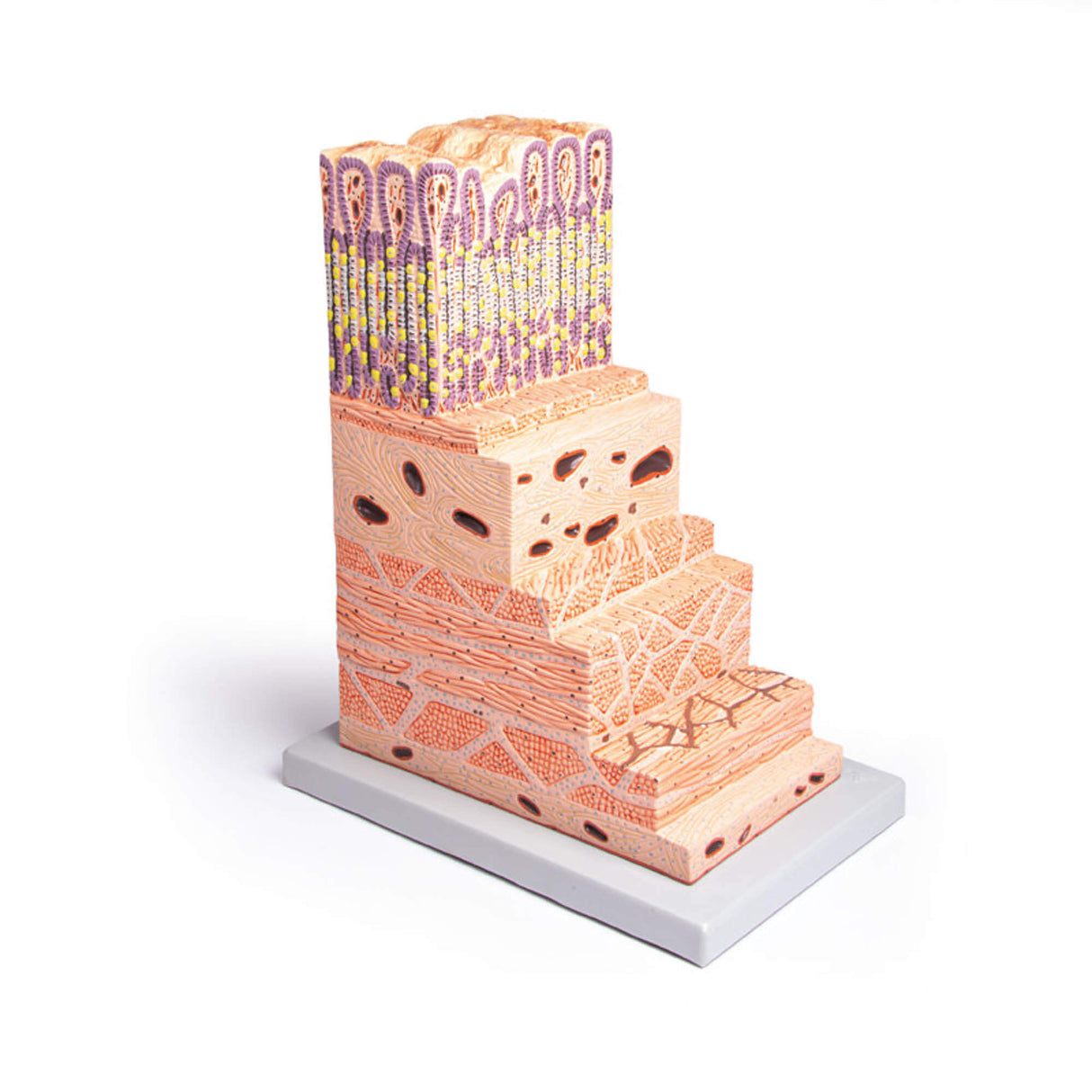 Erler-Zimmer Magenwand