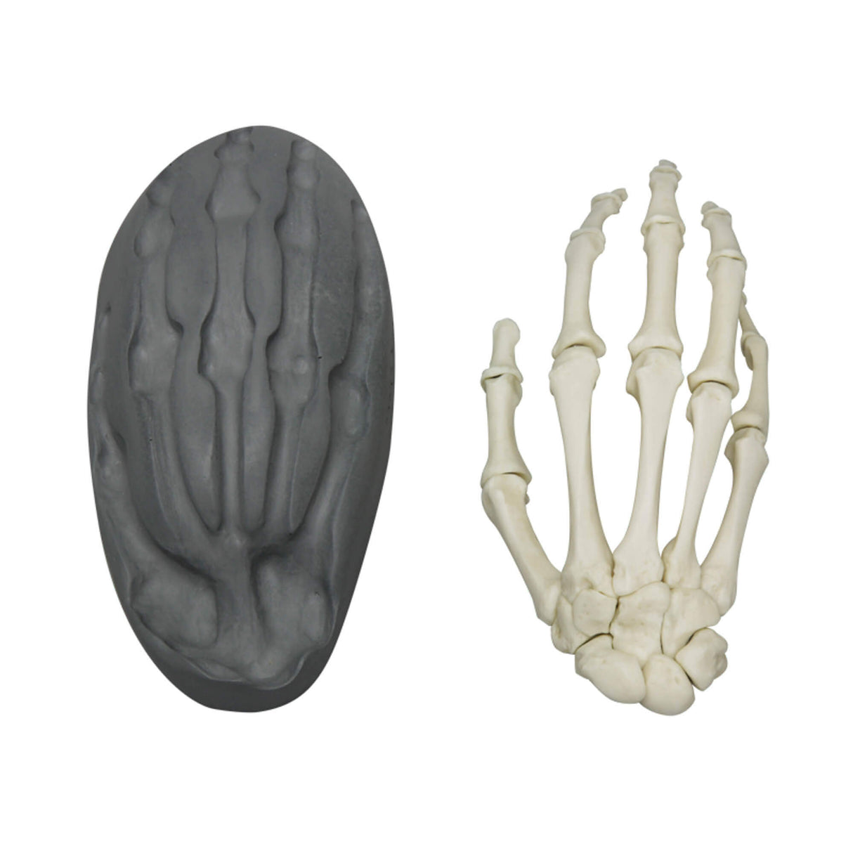 Erler-Zimmer Magnetische menschliche Hand, rechts