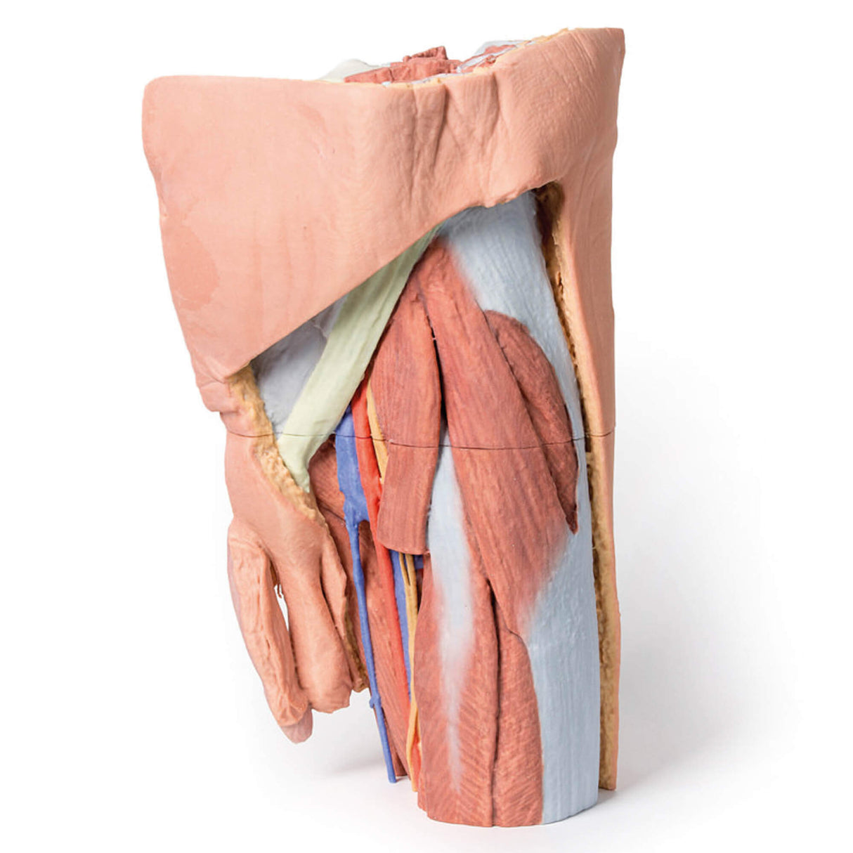 Erler-Zimmer Männliches linkes Becken und proximaler Oberschenkel