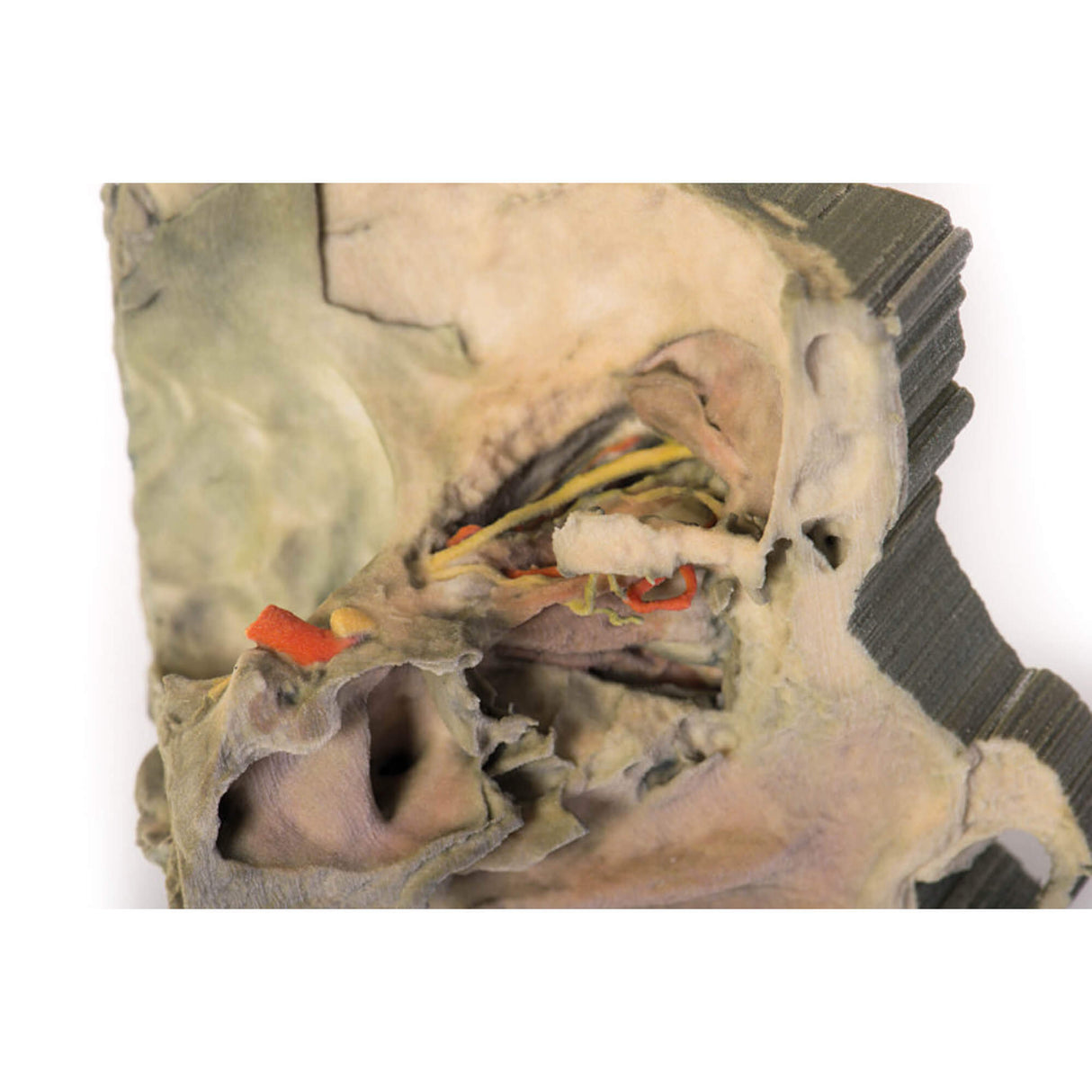 Erler-Zimmer Mediale Orbita