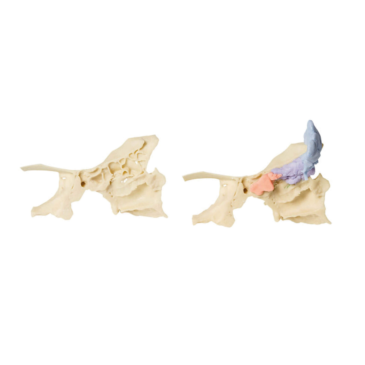 Erler-Zimmer Modell der Nasennebenhöhlen