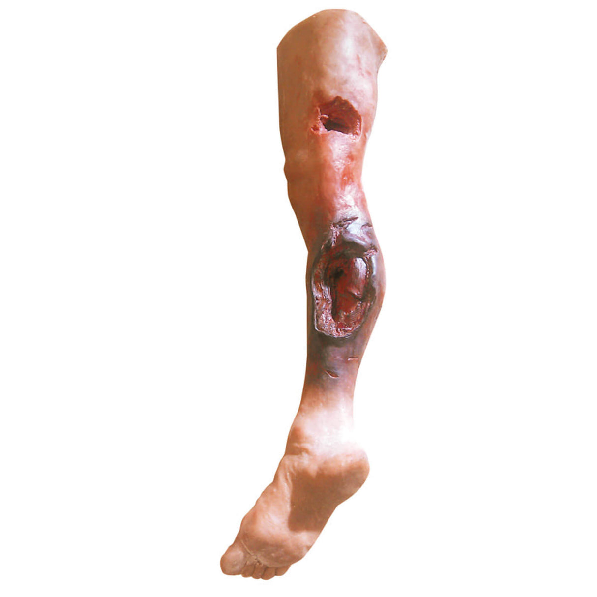 Erler-Zimmer Notfallbein