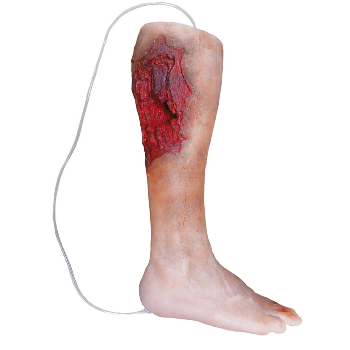 Erler-Zimmer Notfall-Unterschenkel