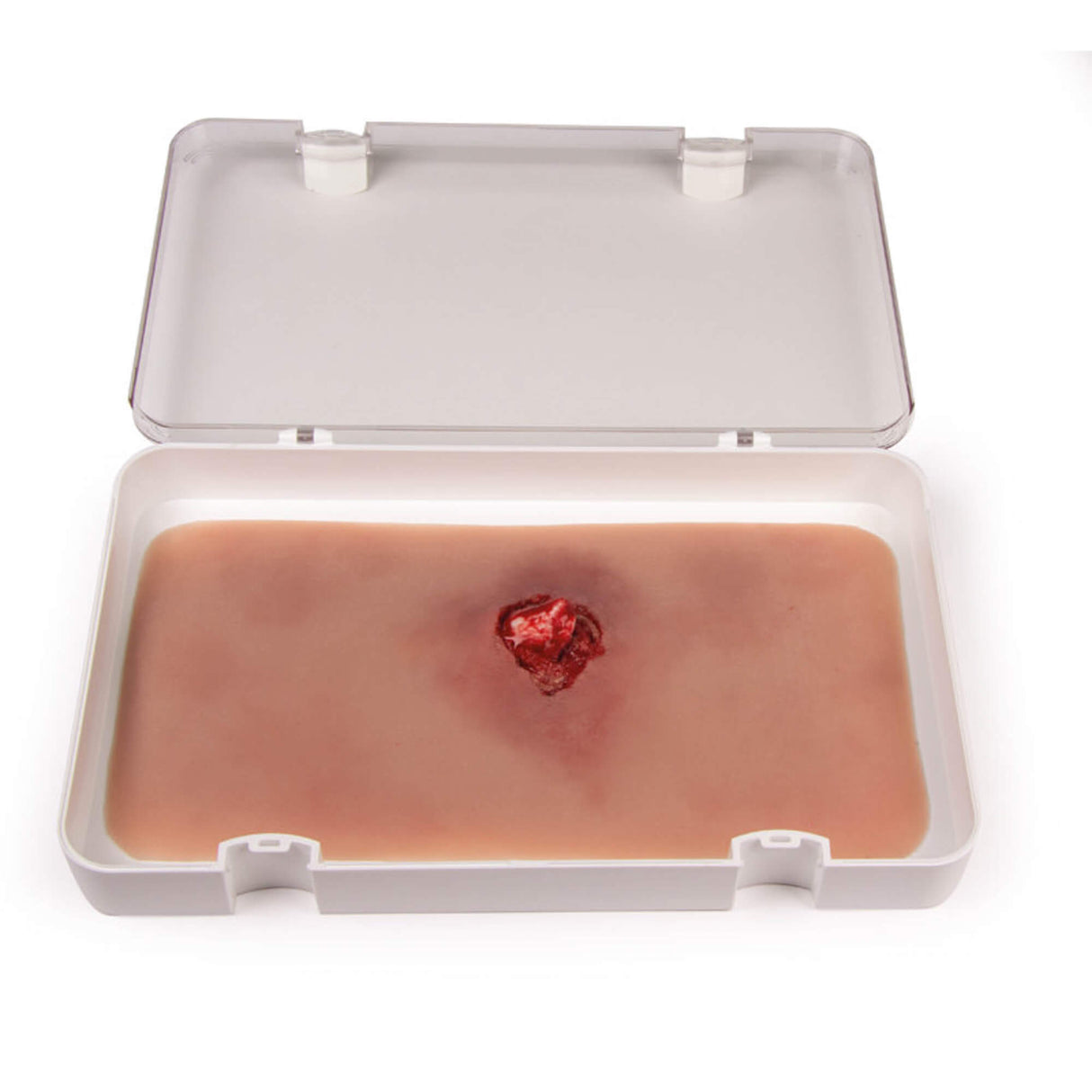 Erler-Zimmer Offener Bruch Arm mit Blutungsfunktion