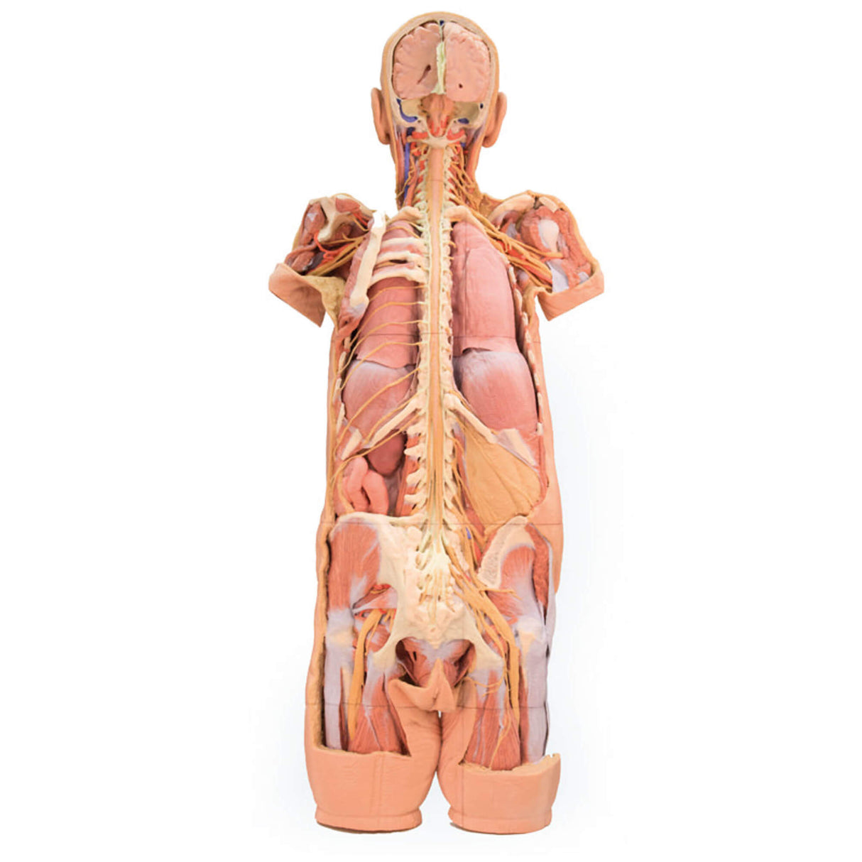 Erler-Zimmer Präparat des Nervensystems (posteriore Ansicht)