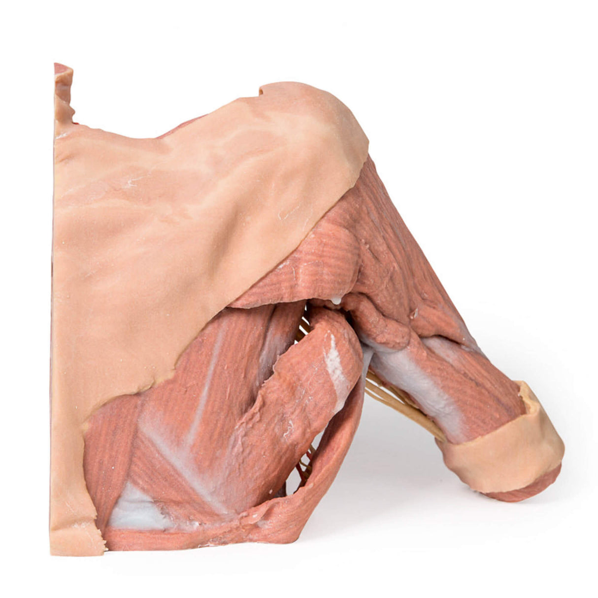 Erler-Zimmer Rechte Brustwandhälfte – Achsel und Halsansatz