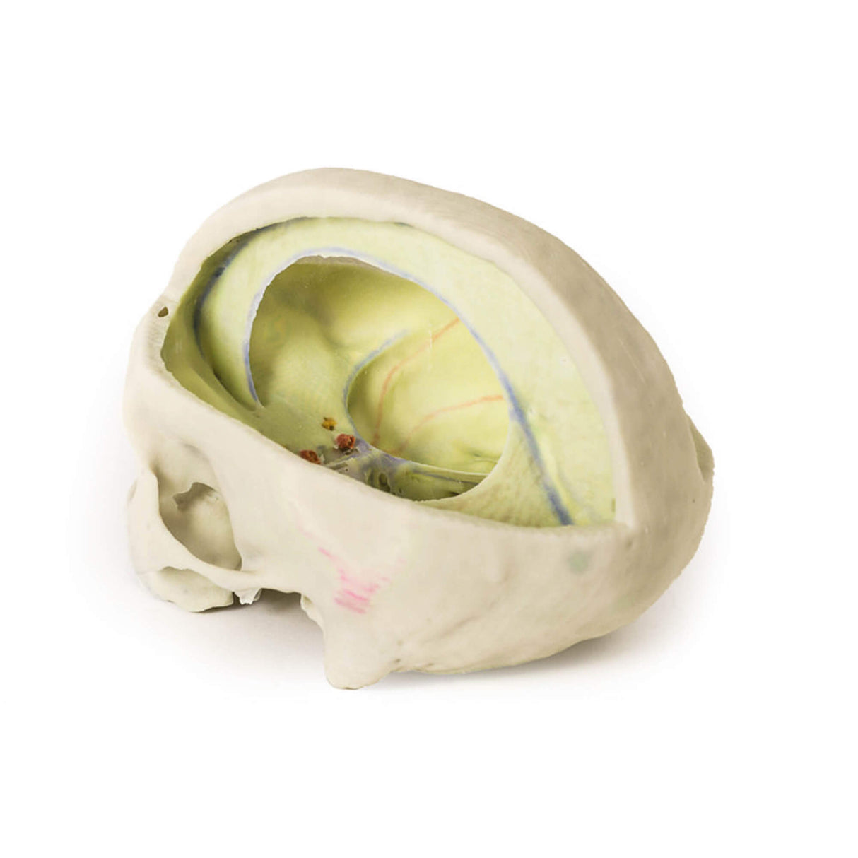 Erler-Zimmer Schädelmodell mit Ansatz der Dura mater