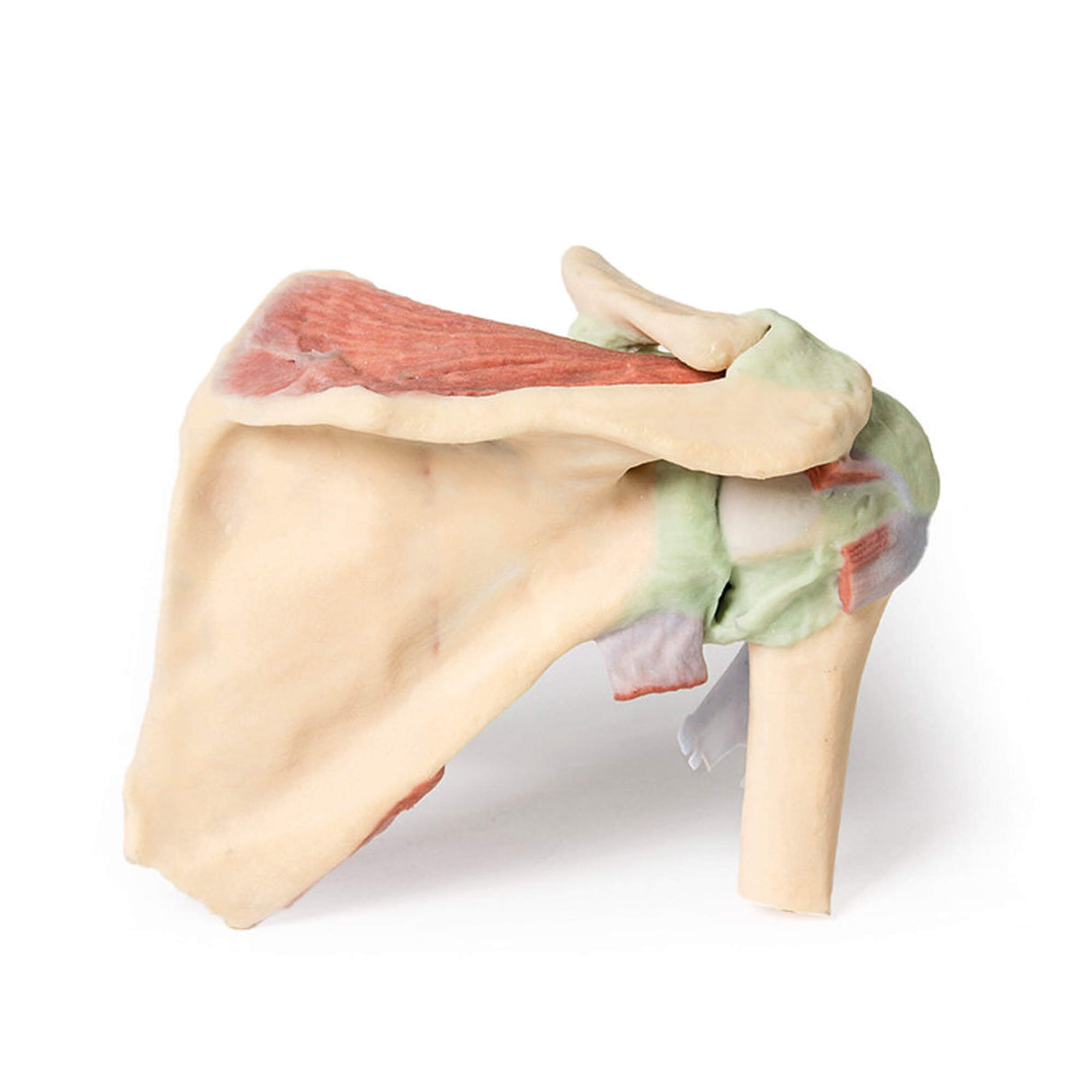 Erler-Zimmer Schulter – tiefe Präparation eines rechten Schultergürtels, bei Erhaltung des vollst. Schulterblatts