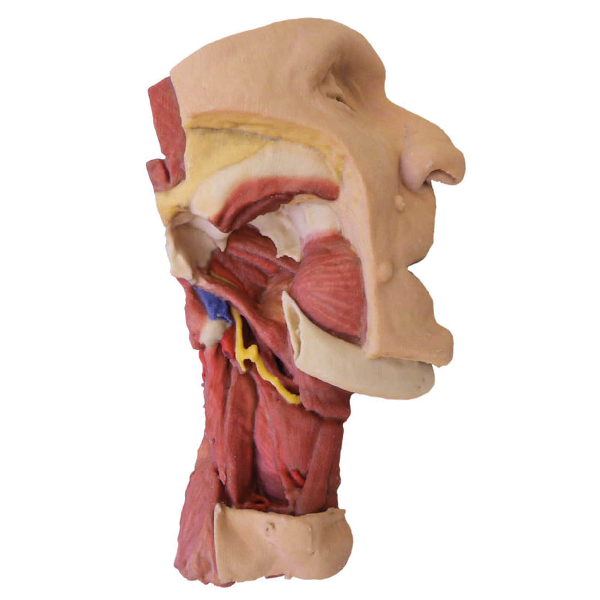 Erler-Zimmer Tiefe Gesichtsknochen/Fossa infratemporalis