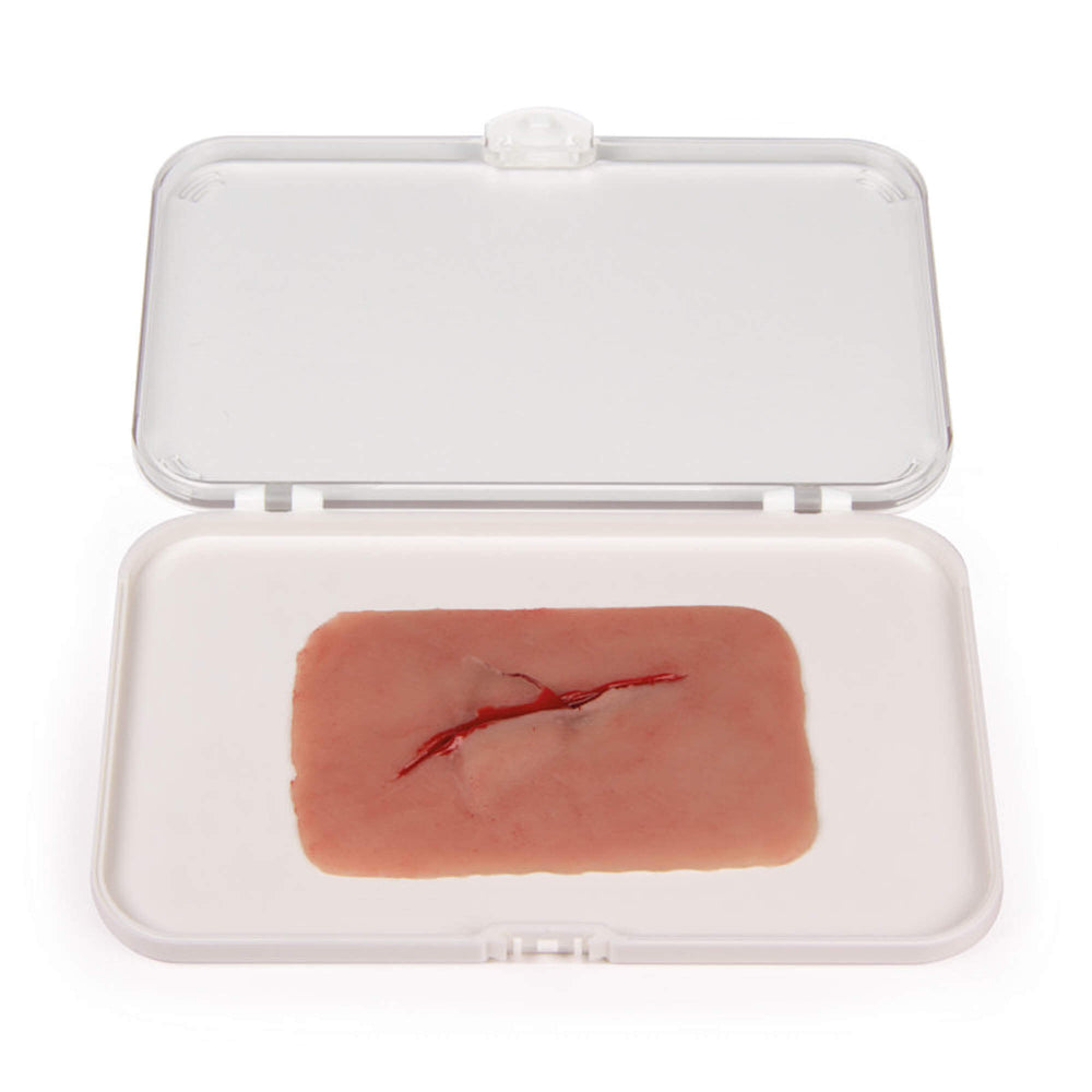 Erler-Zimmer Wundmoulage Schnittwunde