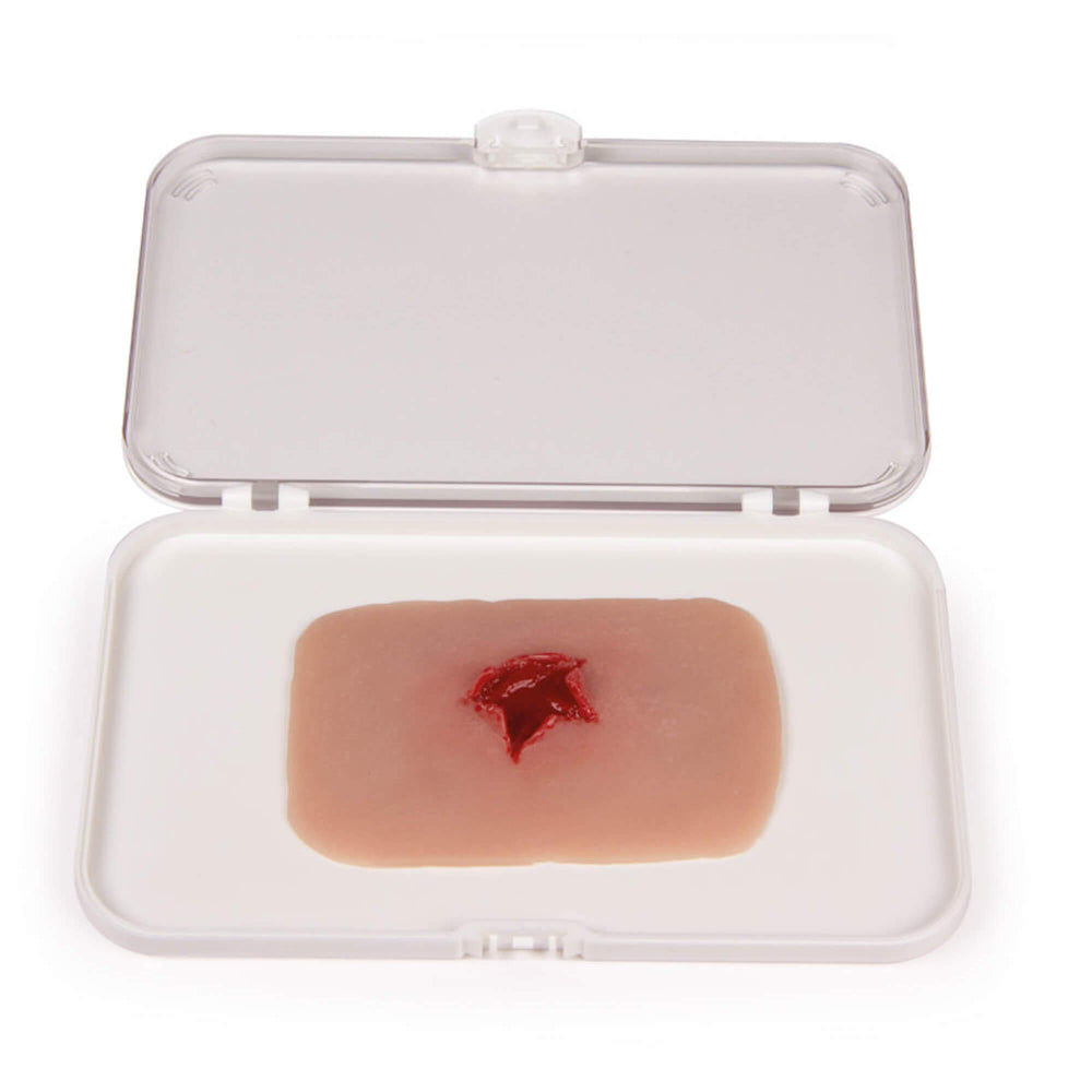 Erler-Zimmer Wundmoulage Schuß Austrittswunde