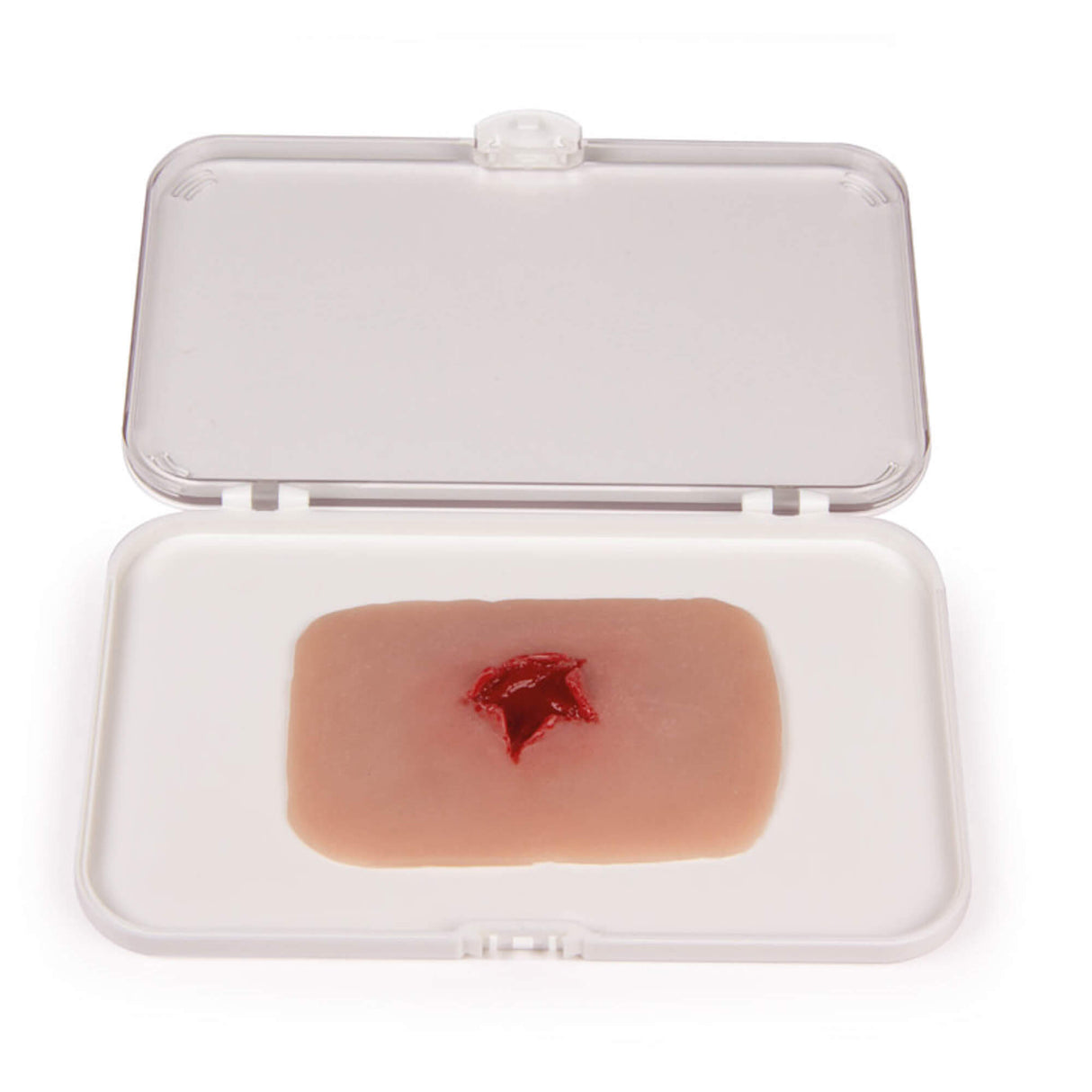 Erler-Zimmer Wundmoulage Schuß Austrittswunde