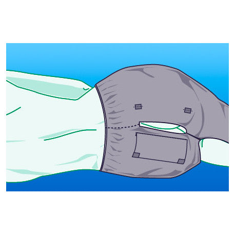 NOBA Endoskopiehose 25 Stück