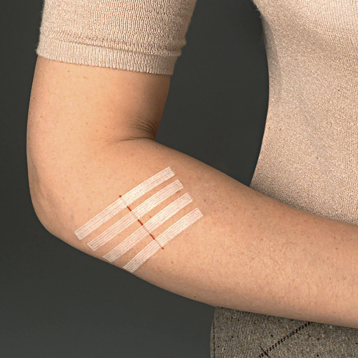 3M Steri-Strip Wundverschlussstreifen 12 x 50 mm (50 x 6 Streifen)