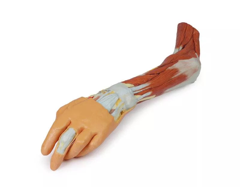Erler-Zimmer Obere Extremität – Ellenbogen, Unterarm und Hand
