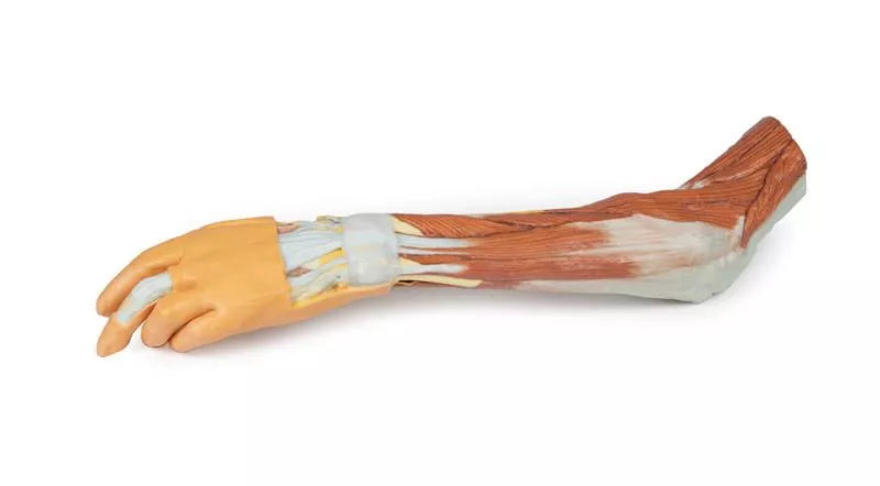 Erler-Zimmer Obere Extremität – Ellenbogen, Unterarm und Hand