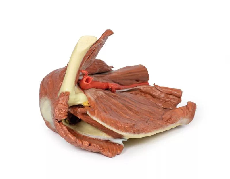 Erler-Zimmer Schulter (links) – Oberflächliche Muskeln mit Arteria axillaris/brachialis